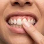 Tooth Is Loose But Still Attached Adults