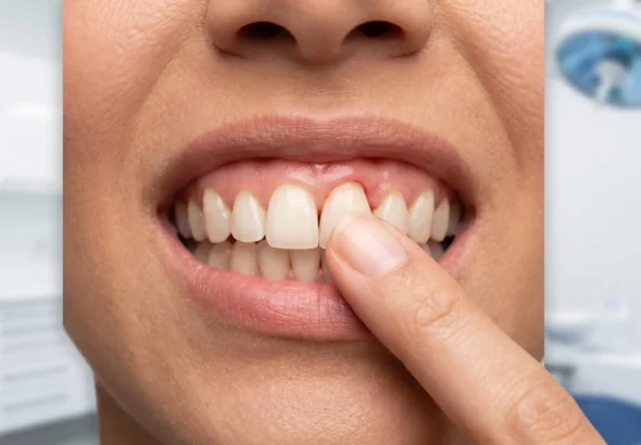 Tooth Is Loose But Still Attached Adults